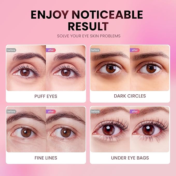 AILEORY Under Eye Patches (24 Pairs) - New Tri-color Glitter Eye Gel Pads for Dark Circles Puffy Eyes,Under eye Bags,Wrinkles|Natural Collagen Under Eye Mask Patches, Gel Under Eye Patches