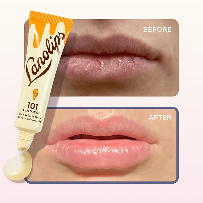 Lanolips 101 Ointment - Lanolin Lip Balm for Smooth, Hydrated & Healthy Lips - Multipurpose Lip Ointment with Lanolin Oil for Dry Lips, Cuticles & More - Dulce de Leche (0.35 oz)