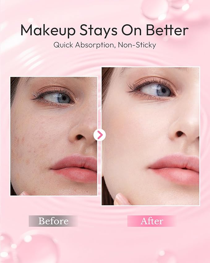 Salmon DNA PDRN Anti-Aging Serum, PDRN Intensive Ampoule, Pre-makeup Skincare, Collagen, Glutathione, Niacinamide & Hyaluronic Acids, Ultra Hydrating Serum, Improves Skin Radiance, 0.05 fl.oz x 30e