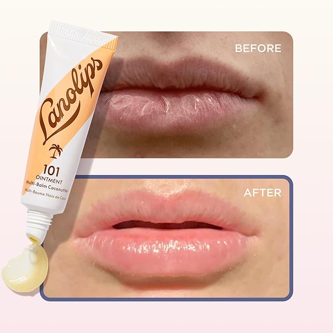 Lanolips 101 Ointment - Lanolin Lip Balm for Smooth, Hydrated & Healthy Lips - Multipurpose Lip Ointment with Lanolin Oil for Dry Lips, Cuticles & More - Coconutter (0.35 oz)