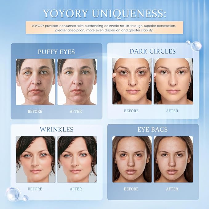 Under Eye Patches Masks - Reduce Puffy Eyes, Dark Circles,Undereye Bags, Wrinkles,Infused Peptide Collagen and Hyaluronic Acid,Vegan Cruelty-Free Self Care