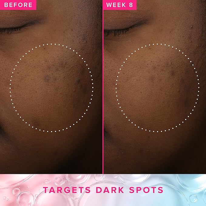 Farmacy 3% TXA Toner for Face - Brightening Face Toner for Oily Skin - Liquid Exfoliant with Azelaic Acid + 5% PHA to Target Visible Dullness + Help Reduce Uneven Skin Tone (50ml)