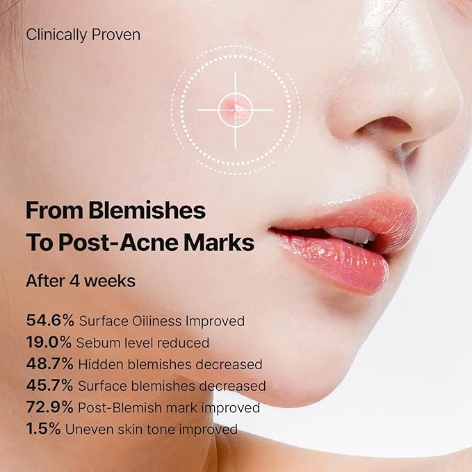 Needly Patch for Blemishes, 24 Patches | Hydrocolloid Microdart Pimple Patch, Micropoint Acne Patch for Early-Stage Zits and Deep Pimples, Acne Spot Cover, Korean Skin Care