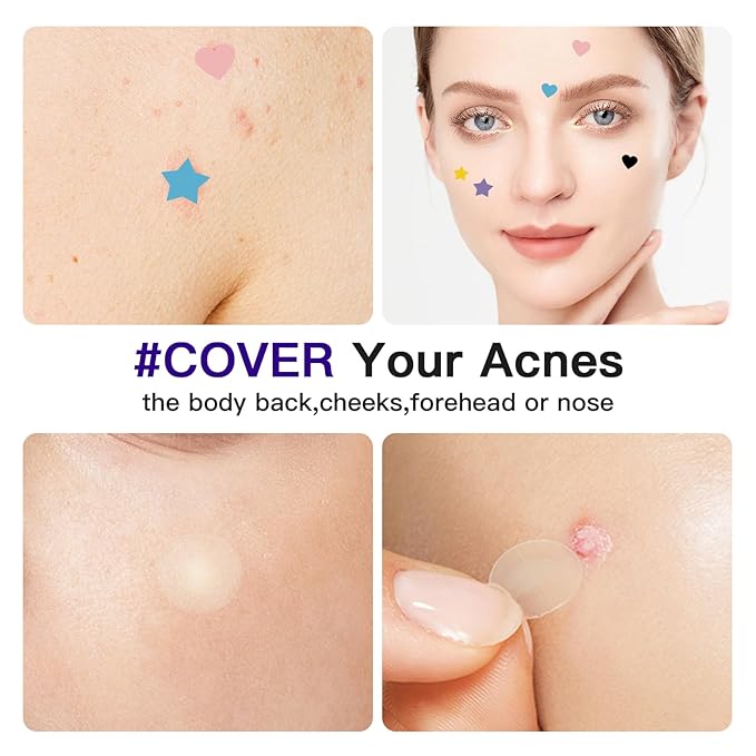 312CT Star Pimple Patches for Face Hydrocolloid Mighty Patch Star&Invisible Acne Patches,5Sizes 6Colors Cute Stickers Acne Pads Parches Acne For Body,Chin,Forehead,Full Face Zit Patch Acne Dots