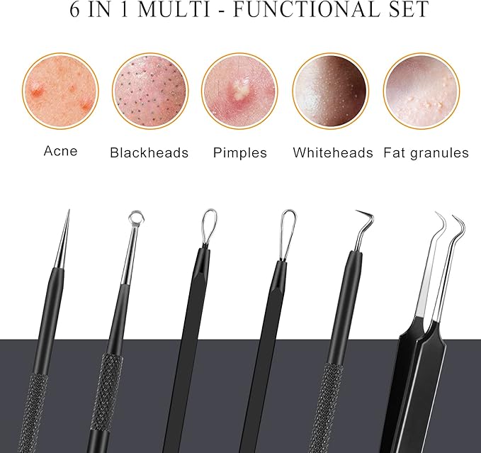 Boxoyx Pimple Popper Tool Kit - 6 Pcs Blackhead Remover Comedone Extractor Tool Kit with Metal Case for Quick and Easy Removal of Pimples, Blackheads, Zit Removing, Forehead, Facial and Nose(Black)