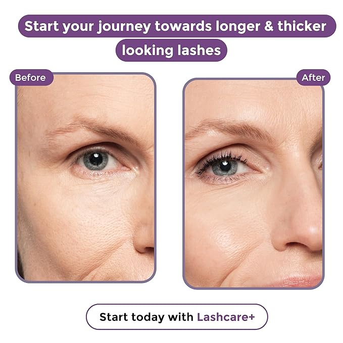 LashCare+ Eyelash Enhancing Serum For Mature Women - Longer, Thicker Lashes in 12 Weeks - For Sensitive Eyes, Natural Growth - Enhancement, Conditioner for Longer-Looking Lashes - 1 Month Supply