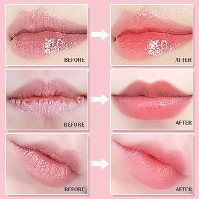 4 PCS Bee Lip Balm Honey Pot-Strawberry, Watermelon, Apple Lime, Honey Lip Mask Overnight Propolis Moisturizing,Vitamin E Prevention Cracked &Chapped Lips,Christmas Gifts Lip Balm