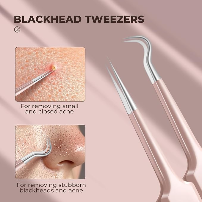 YGQQOY Professional Blackhead Tweezers, Stainless Steel Blackhead Remover Tools, Pimple Popper Tool Kit for Acne Whitehead Blemish, Pore Prep Tool
