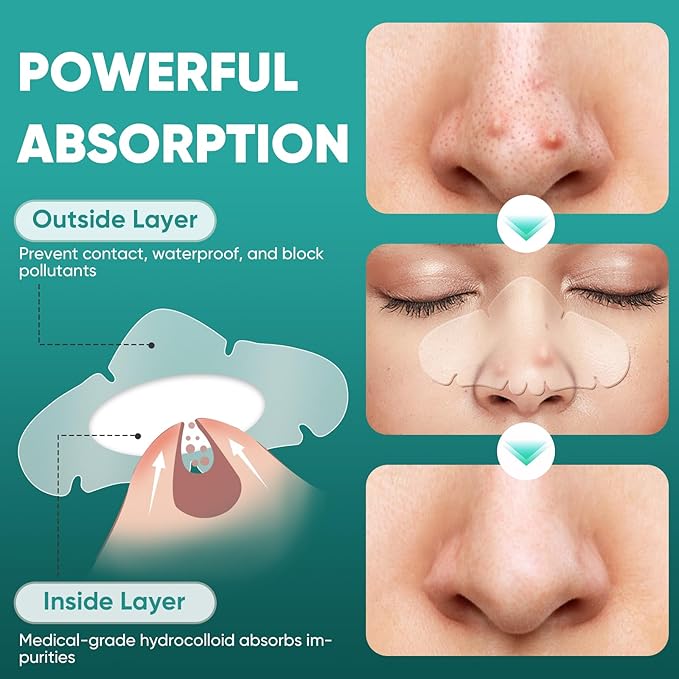 30 Count Nose Pore Patches, Medical-Grade Hydrocolloid Pore Strips, Overnight Oil-Absorbing & Pore-Refining, Pimple Stickers to Absorb Acne Nose Gunk