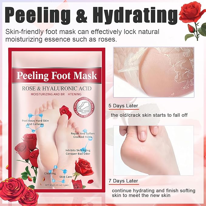 5Pcs Foot Peel Mask for Dry Cracked Feet, Rose Extract Moisturizing Foot Masks, Exfoliating Foot Peeling Socks for Women & Men, Hydrating Foot Mask for Soft Smooth Feet Spa at Home