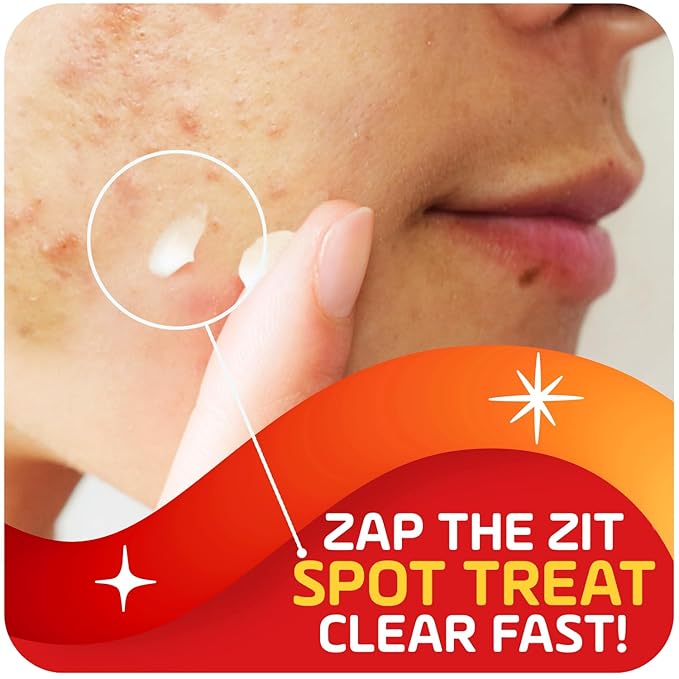 Asepxia 2% Salicylic Acid Acne Spot Treatment Cream | Drying Formula Targets Acne, Clears & Prevents Blemishes, Reduces Redness, Penetrates Pores, Pimple Cream, 1 Oz, 3-Pack