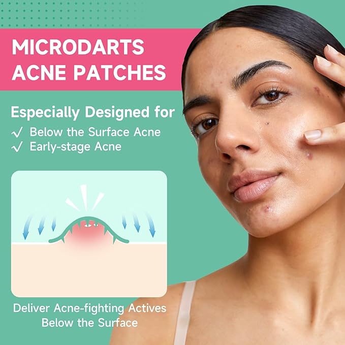 TEAWOO 72-Count Microdart Acne Patches, Hydrocolloid Pimple Patches with Salicylic Acid & Madecossoside, Microdart Zit Patches for Deep Blemishes & Early Stage Acne (Patented)