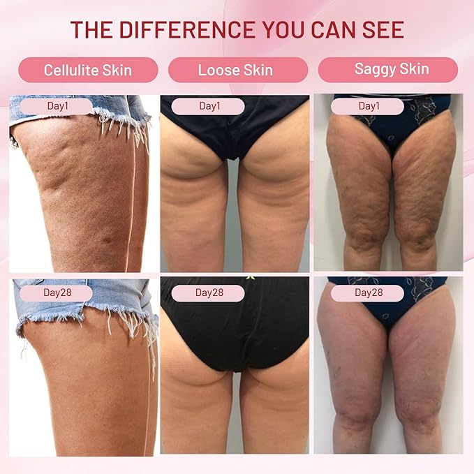 Inner Thigh Firming Cream - Remove Cellulite, Lift the Loose Skin for Legs, Help Tighten the Appearance Of Saggy Body Korean Skincare 4.23 Fl Oz