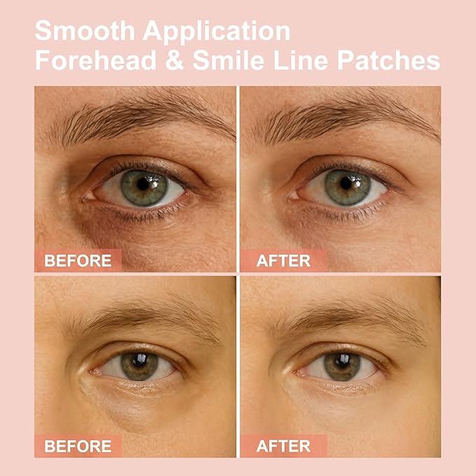 Micro Eye Patches, Deeply Hydrating Anti-Wrinkle Patches, Contains Hyaluronic Acid and Collagen for Dark Circles, Smooth Application Forehead & Smile Line Patches for Women (1)