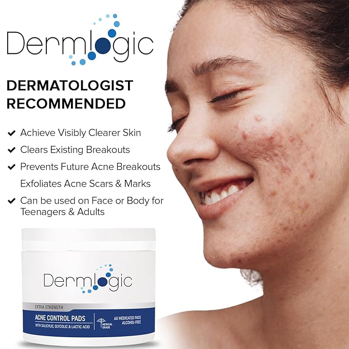 Acne Treatment Pads-Contains Glycolic, Lactic, Salicylic Acid. Eliminates Oily Skin, Clogged Pores & Cystic Breakouts. Removes Dark Spots, Whitehead & Blackhead Pimples for Face & Body.