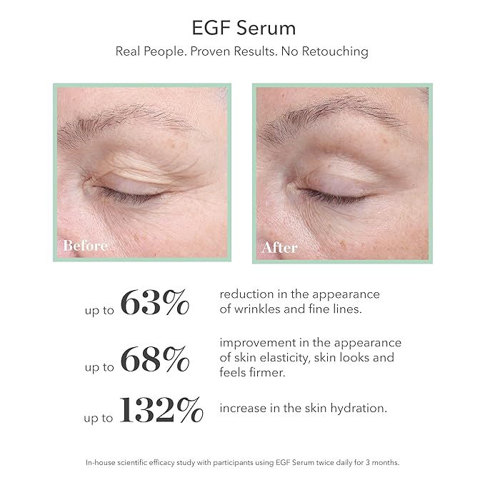 BIOEFFECT EGF Serum | Barley-Derived Epidermal Growth Factor + Hyaluronic Acid | Anti-Aging Face Serum for Fine Lines & Wrinkles, Hydration & Firmness, 20 mL / 0.68 oz