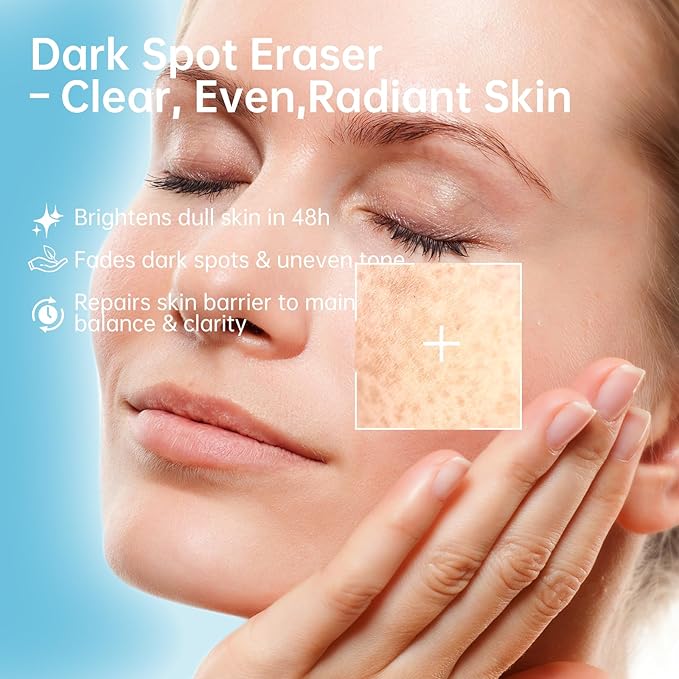 Even Tone & Blemish Serum - Skin Brightening & Repair Treatment for Face | Reduces Dark Spots & Acne Marks | Nourishing Smoothing Formula for All Skin Types, 1 fl.oz/30ml