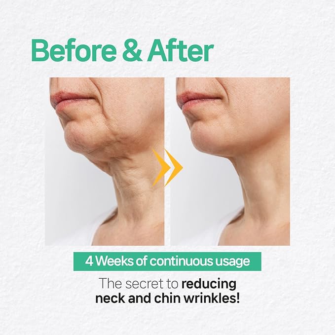 Wooshin Labottach V Line Face Lifting Collagen Sleeping Mask 4ct – Double Chin Reducer & Neck Wrinkle Patches with Hyaluronic Acid & Vitamin E, Chin Strap Care, Neck Lift Tape Overnight