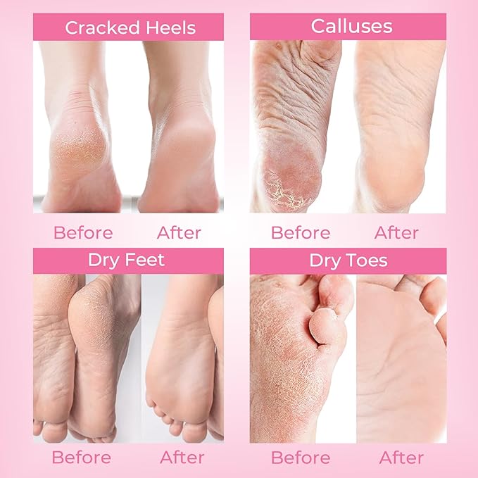 SAISZE Foot Peeling Mask, 4 Pairs Foot Peel Mask for Dry Cracked Feet, Dead Skin Callus Removal, Repair Soft Feet