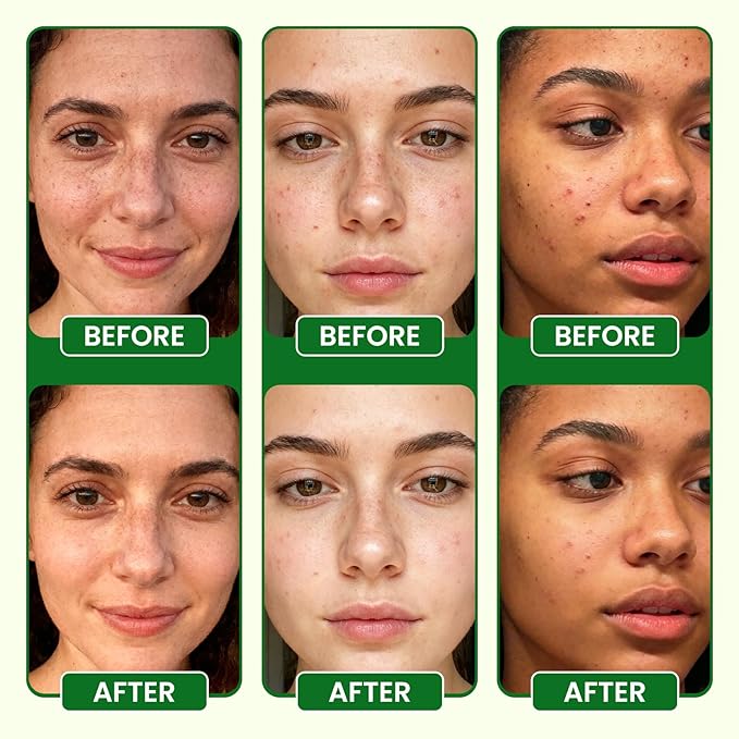 Lukaree Vitamin C Serum for Face – Brightening Vitamina C Facial Serum with Sodium Hyaluronate | Evens Skin Tone & Smooths Fine Lines | Antioxidant-Rich Beauty Product for All Skin Types,1 Fl Oz