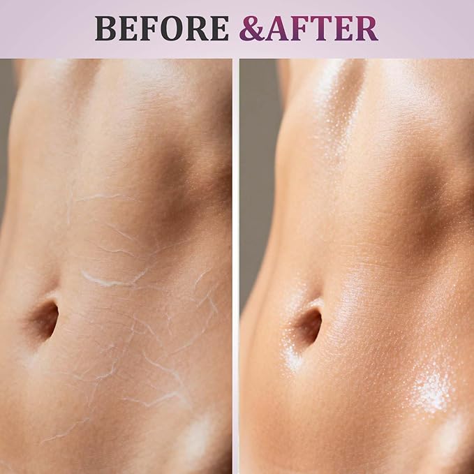 2 PCS Body Firming Oil - Fast-Absorbing Hydration to Tighten & Firm Arms, Chest, Thighs - Enriched with Vitamin E, Rosehip, Almond Oils - Post-Shower Treatment for Women 2x100ml
