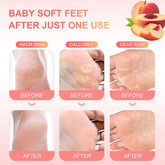 FUNNIR Foot Peeling Mask Exfoliant for Peeling Off Calluses, Natural Exfoliator for Dry Dead Skin, Callus, Repair Rough Heels Soft Smooth Touch