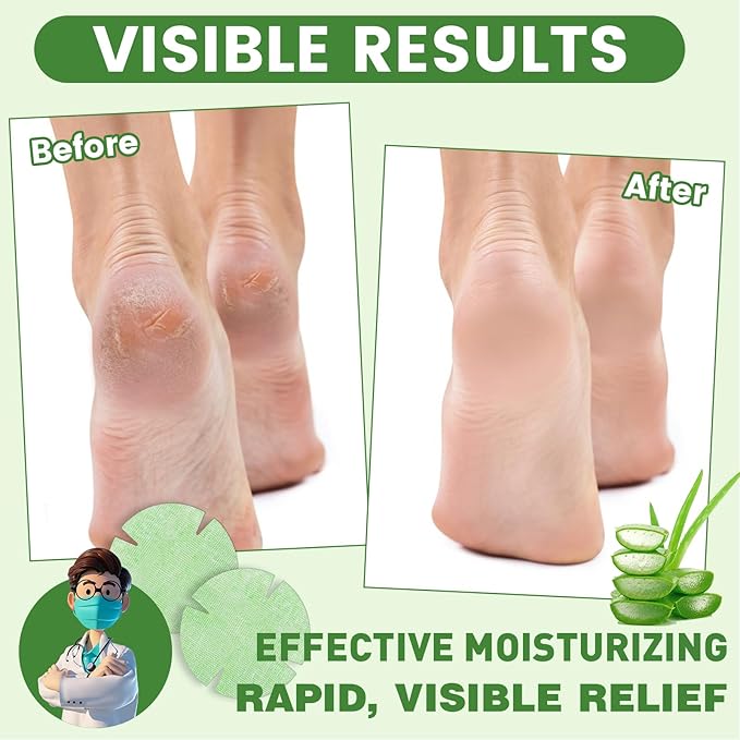 TEAWOO 30PCS Patented Aloe Vera Cracked Heel Treatment Patches, New Upgraded Cracked Heel Repair Bandage