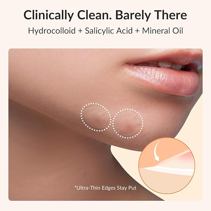 Invisible Pimple Patches – 4 Sizes Miracle Patches for Pimples with Hydrocolloid & Salicylic Acid, Korean Acne Patches for Face, Zit Stickers, Blemish Patches, Acne Spot Dots – 144 Count