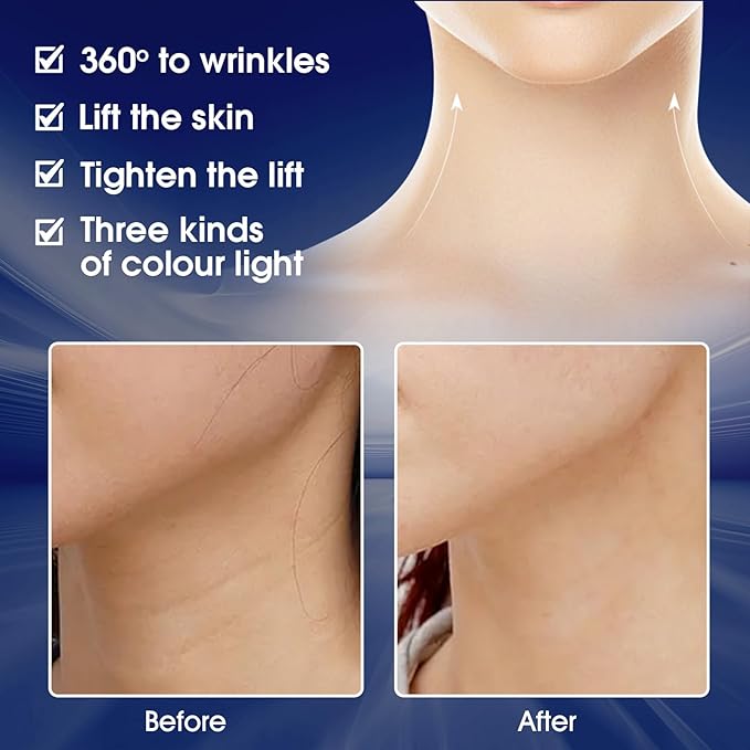 Neck Firming Device, Neck Tightening Machine Wrinkles Remover for Neck Lift, Led Red Blue Green Light