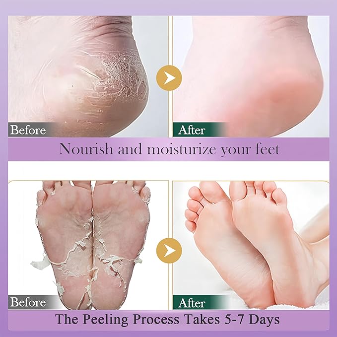 Lavender Foot Peel Mask 5 Pairs, Exfoliating Foot Masks That Remove Dead Skin, Hydrating Foot Mask Socks for Dry Cracked Feet, Moisturizing Foot Exfoliator for Women & Men Spa at Home