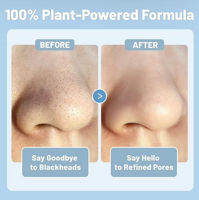 Herbal Blackhead Cleanse Kit Nose Pore Strips, Plant-Powered Deep Cleansing Blackhead Remover Strip Set