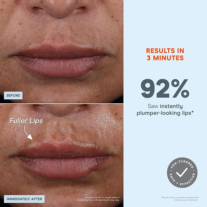 NuFACE FIX MicroWand Microcurrent Facial Device, FDA Cleared - Eyes, Lips & Lines Treatment with Serum Activator - Lip Plumper, Eye Depuffing Wand, Wrinkle & Smile Line Reducer, 3 On-The-Go Modes