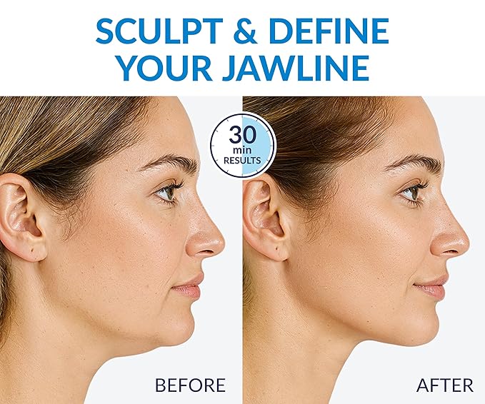 STYLIA MaxiLift V-Line Lifting Collagen Face Mask - Advanced Double Chin Reducer - Jawline Shaper - Neck Firming and Tightening Mask with Hyaluronic Acid & Aloe Vera - Chin Strap for Sleeping (5PC)
