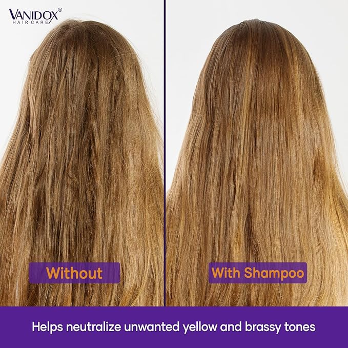 VANIDOX Sulfate Free Brass Toning Purple Shampoo for Blondes, Brown Highlighted, or Bleached Hair, Infused with Purple Rice Extract, Hyaluronic Acid, Vitamin E, and Chamomile Extract (16 fl oz)
