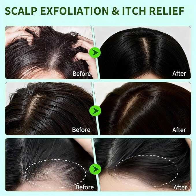 Criszenv Scalp Scrub,Scalp Exfoliator with Rosemary & Mint,Hair Treatment for Itchy Scalp, Dandruff & Buildup Removal, Clarifying Scrub Shampoo with Scalp Massager for Detox & Nourishment/8.8oz