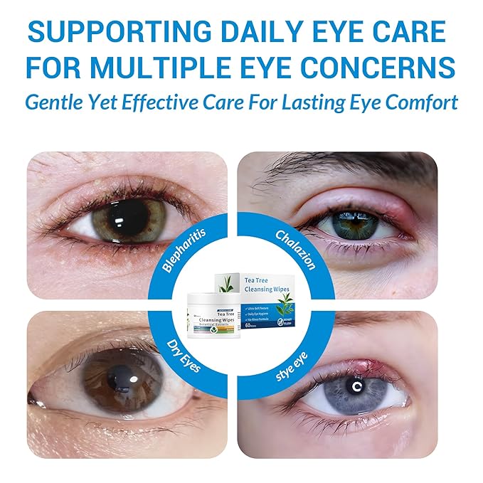 60 Pcs Tea Tree Oil Eyelid & Lash & Face Cleansing Wipes l Eyelid Pads For People Blepharitis & Chalazion & DryEyes & Stye Eye Treatment, Eyelash Makeup Remover & Daily Eye Lid Pads, Cleaning Wipes