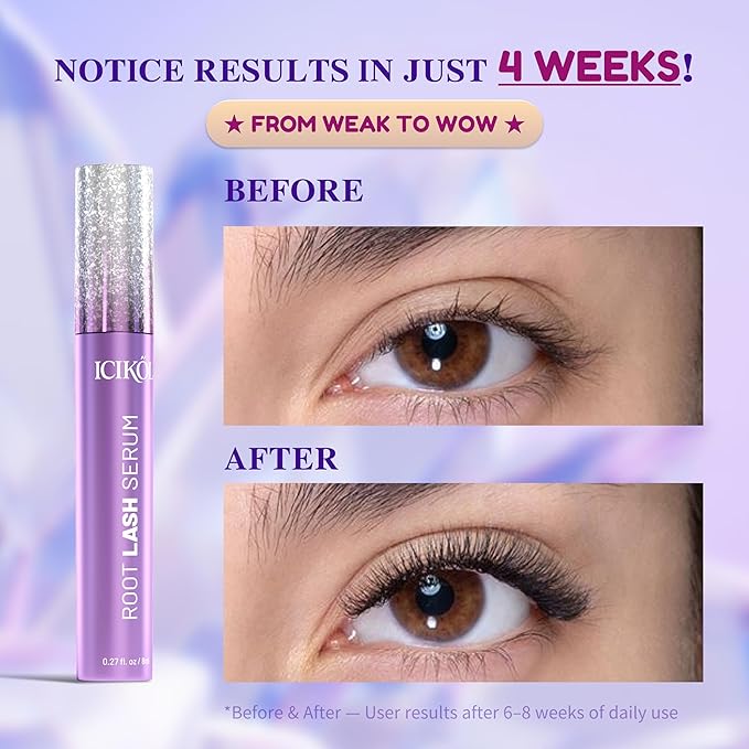 Lash Serum for Eyelash Growth, Advanced Peptide & Biotin Formula for Thicker, Fuller, Longer Lashes in 4-6 Weeks, Prostaglandin-Free Lash Enhancer for Women 35+ (Eyelash Serum - 16mL)