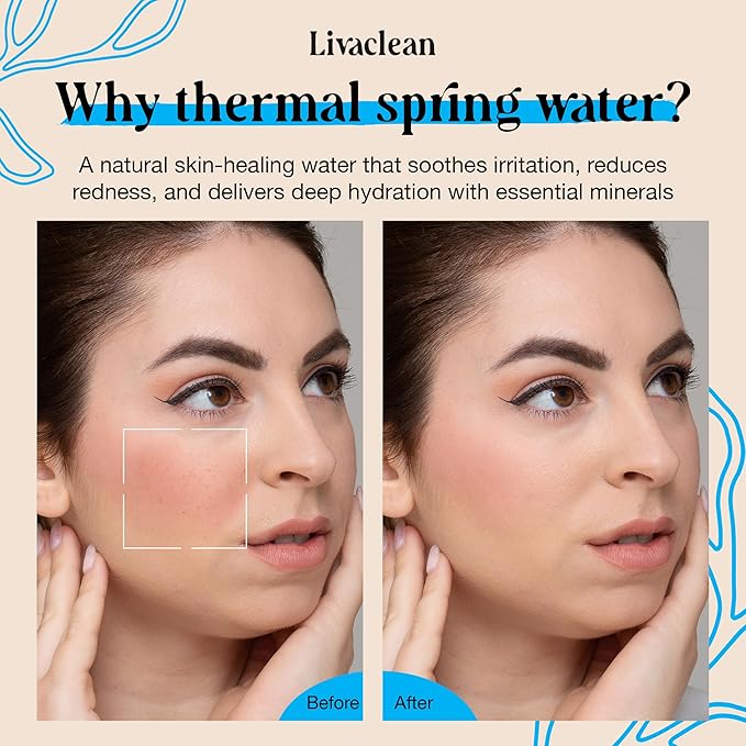 300ml + 50ml Thermal Spring Water Face Spray Mist Hydrating w/ Hyaluronic Acid & Aloe Vera - Hydrating Face Mist, Soothing & Calming, Mineral-Rich Skin Nourishment, Refreshing, 10 fl oz + 1.7 fl oz
