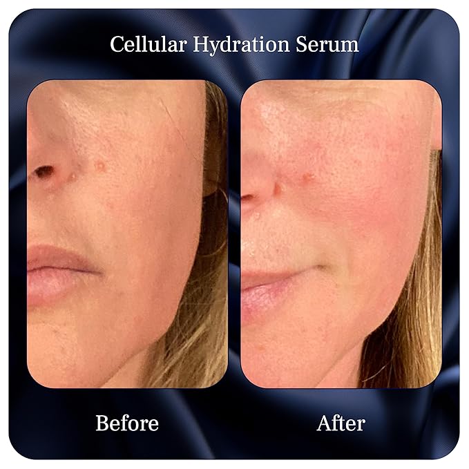 Cellular Hydration Serum - Hyaluronic Acid Alternative - Face Skin Serum for Hydrating - For Women & Men - With Witch Hazel, Glycerin, Aloe, Calendula, Turkey Tail, Tremella Mushroom & More - 1 Fl Oz
