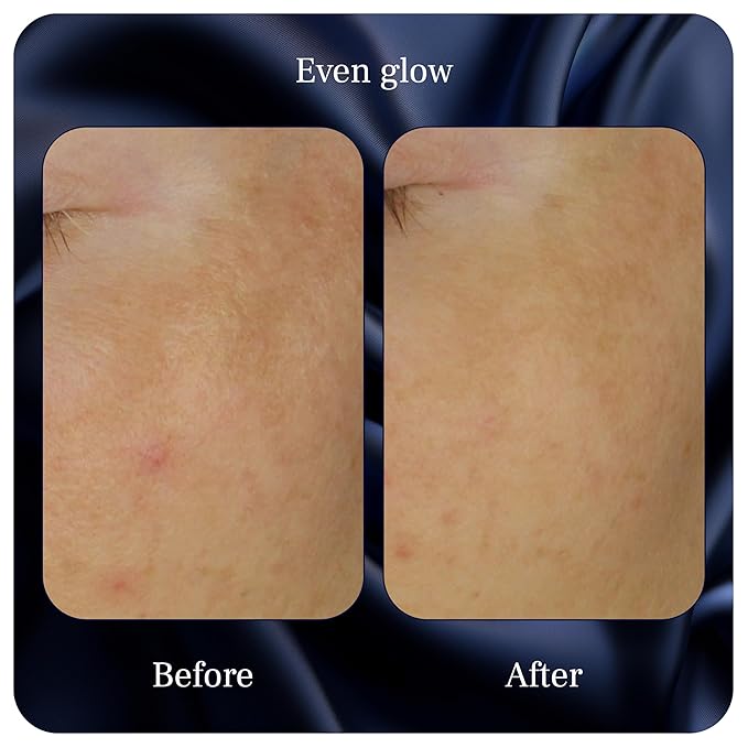 Even Glow - Organic Vitamin C Serum for Dark Spots on Face - Dark Spot Corrector, Dark Spot Remover for Face & Body - with Kakadu Plum Extract, Maple Leaf Extract, Aloe Leaf Juice & More - 1 Fl Oz