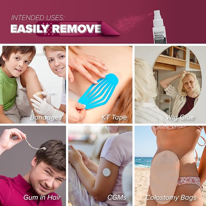 Medical Adhesive Remover for Skin | Wig, Ostomy, Tape, and Bandage Adhesive Remover | Silicone-Based, Hypoallergenic, Sting-Free | 4oz Spray