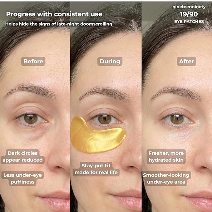 19/90 Under Eye Patches for Dark Circles & Puffiness – Hydrogel Eye Masks with Caffeine, Niacinamide & Collagen – Helps Reduce the Look of Bags & Fine Lines, Gold, (15 Pairs)