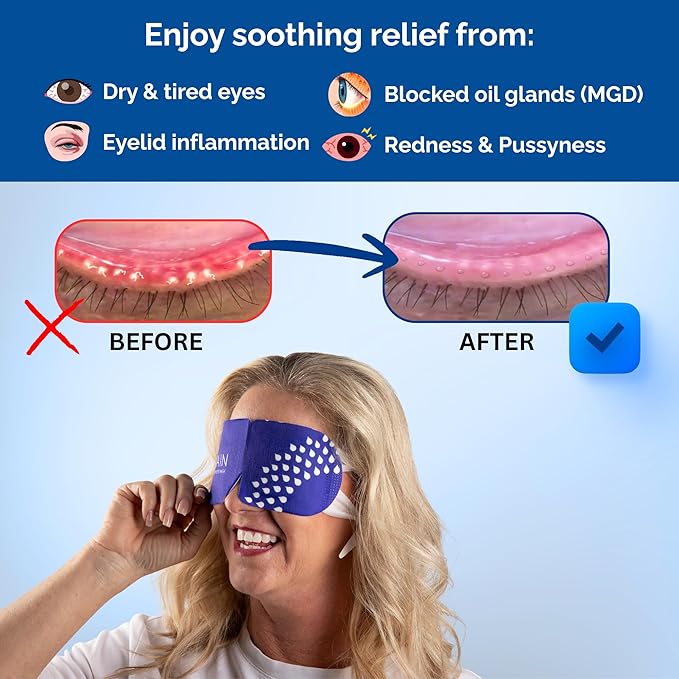 Rain Self Heating Steam Eye Mask for Dry Eyes - Warming Eye Compress with Moist Heat Therapy - Disposable Hot Compress Relief for Stye Treatment, Eye Fatigue & Dry Eye Relief (20 Pack)