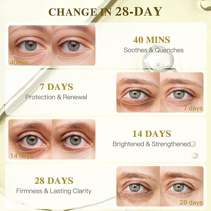 Collagen Under Eye Patches for Puffy Eyes and Dark Circles, Under Eye Mask for Dark Spots with Turmeric, Hydrating Undereye Mask Patches, Christmas Small Gifts for Women (12 Pairs, Turmeric)