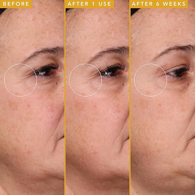 Farmacy Filling Good Hyaluronic Acid Serum for Face - Anti Aging Skin Care + Hydrating Face Serum - Plumps, Smoothes & Helps to Visibly Improve Skin Firmness for a Youthful Complexion (5ml)