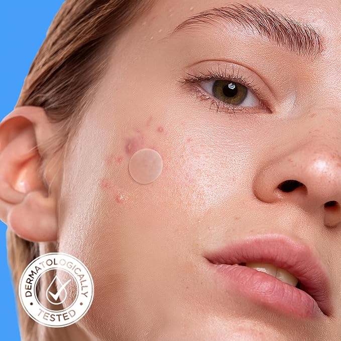AVARELLE Pimple Patches for Face | Hydrocolloid Acne Patches for Covering Blemishes | Zit Patches with Tea Tree, Calendula, & Cica | HSA Store Eligible Items (10-14 mm, 200, Count)