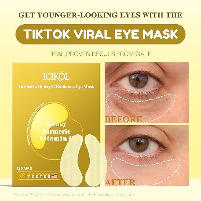 Collagen Under Eye Patches for Puffy Eyes and Dark Circles, Under Eye Mask for Dark Spots with Turmeric, Hydrating Undereye Mask Patches, Christmas Small Gifts for Women (12 Pairs, Turmeric)