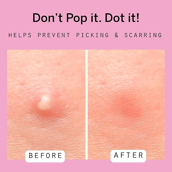 Pixie Cup Dot Hydrocolloid Blemish Patches for Face – Invisible Skin-Covering Stickers with Tea Tree Oil & Vitamin C – Ultra-Thin Cosmetic Patches for Visible Blemishes (8 & 12 mm, 108 ct)