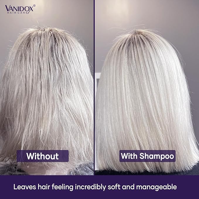 VANIDOX Sulfate Free Brass Toning Purple Shampoo and Conditioner Set for Grey and Silver Hair, Moisturizing & Color-Safe, Enhances Shine & Brightness, Made in USA (16 fl oz each)