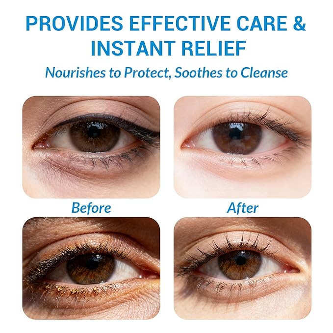 60 Pcs Tea Tree Oil Eyelid & Lash & Face Cleansing Wipes l Eyelid Pads For People Blepharitis & Chalazion & DryEyes & Stye Eye Treatment, Eyelash Makeup Remover & Daily Eye Lid Pads, Cleaning Wipes